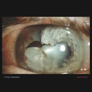 Anaesthesia — Flying Horseman